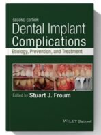 dental implant complications