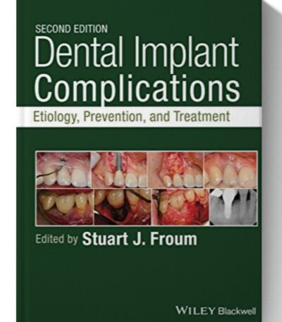 dental implant complications