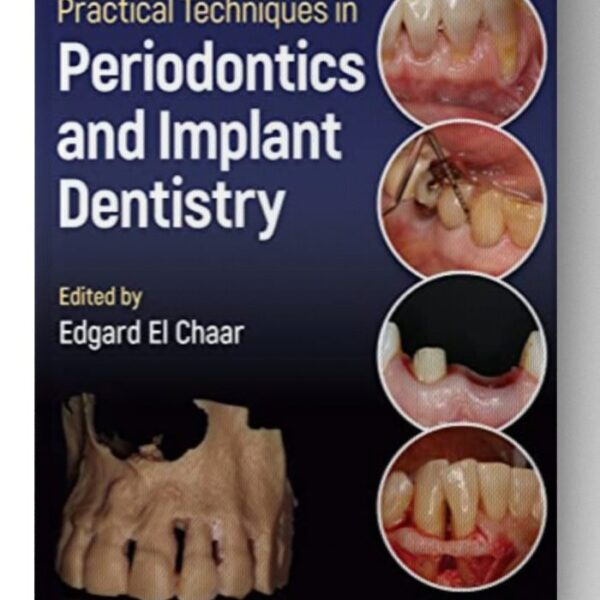 practical techniques in periodontics and implant dentistry