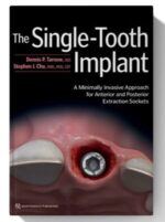 the single tooth implant