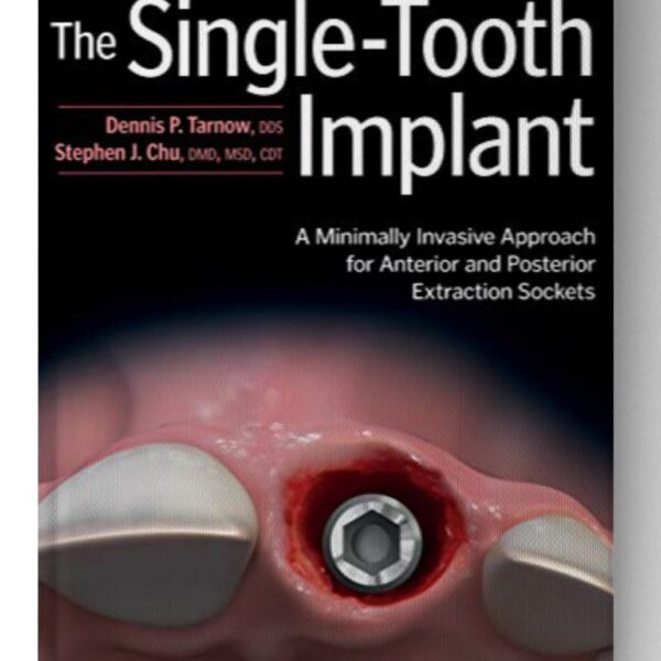 the single tooth implant