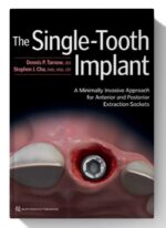 the single tooth implant