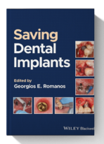 saving dental implants book