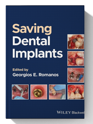 saving dental implants book