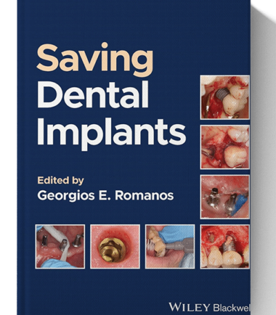 saving dental implants book