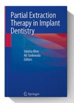 partial extraction therapy in implant dentistry