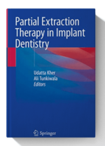 partial extraction therapy in implant dentistry