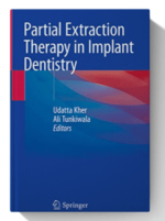 partial extraction therapy in implant dentistry