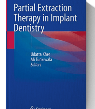 partial extraction therapy in implant dentistry