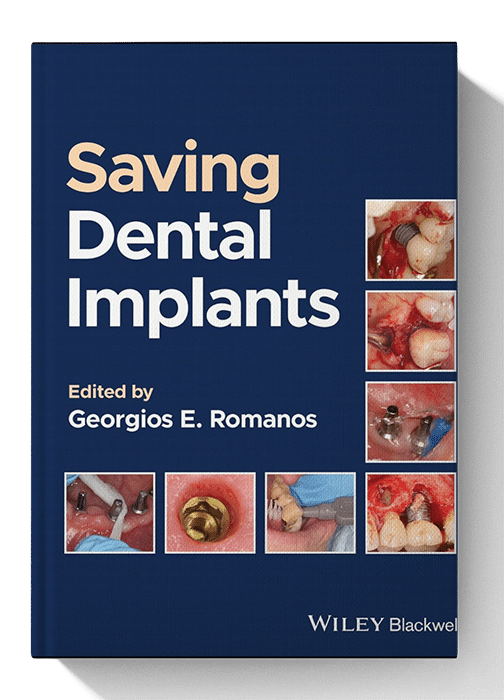 saving dental implants book