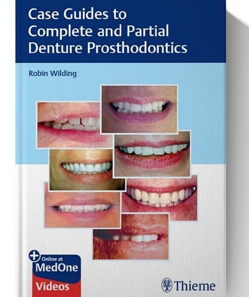 Case Guides to Complete and Partial Denture Prosthodontics