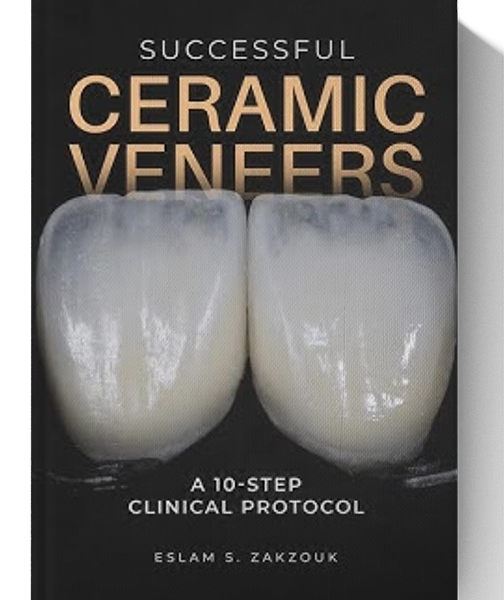 Successful Ceramic Veneers: 10 Steps Clinical Protocol