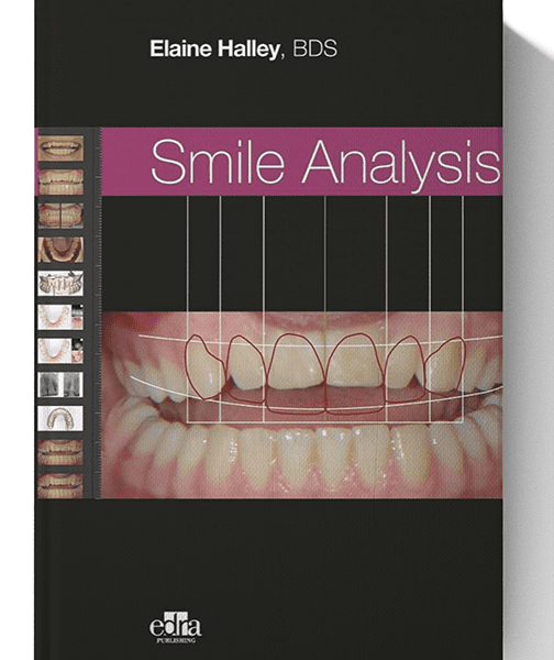 Smile Analysis 1st Edition