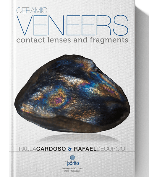 Ceramic Veneers Contact Lenses and Fragments