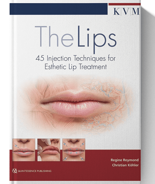 45 Injection Techniques for Esthetic Lip Treatment 1st Edition