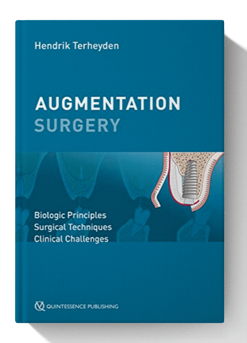 Augmentation Surgery