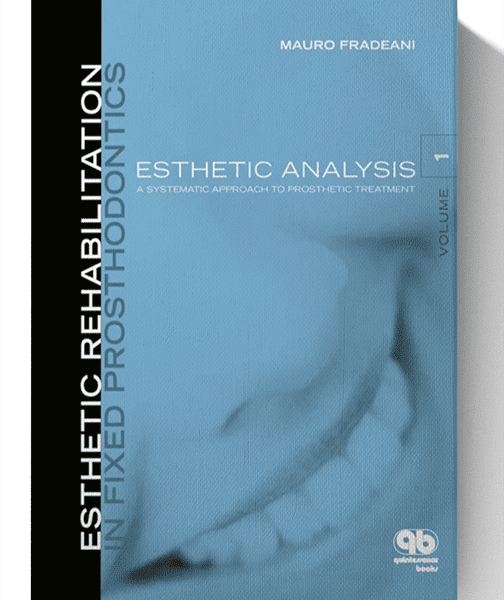 Esthetic Rehabilitation In Fixed Prosthodontics