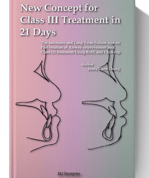 New Concept for Class III Treatment in 21 Days