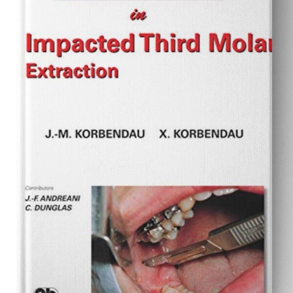 Clinical Success in Impacted Third Molar Extraction