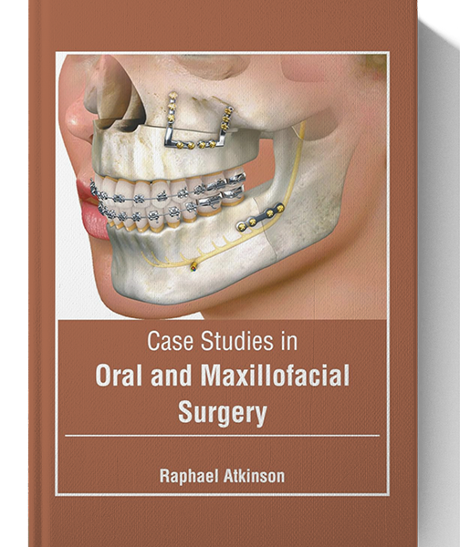 Case Studies in Oral and Maxillofacial Surgery