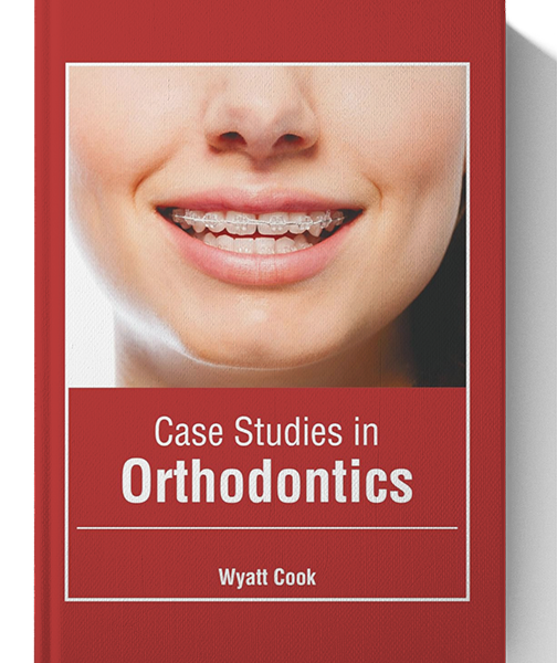 Case Studies in Orthodontics