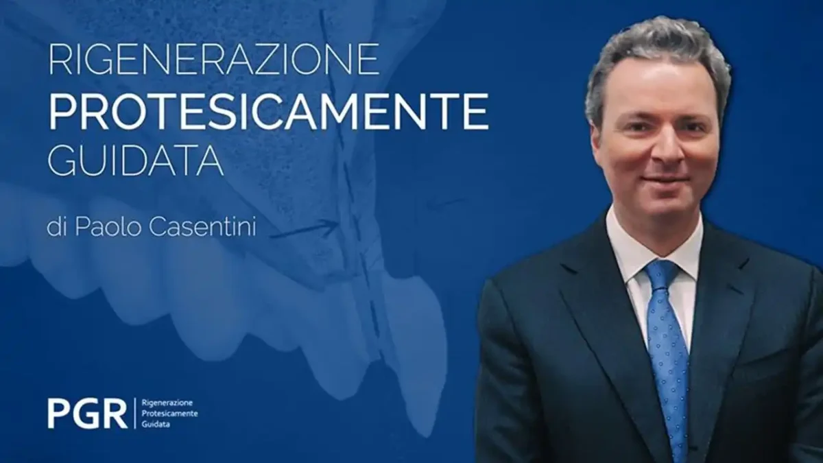 Rigenerazione Protesicamente Guidata