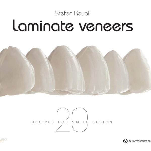 Laminate Veneers: 20 Recipes for Smile Design 1st Edition