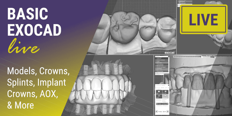 BASIC EXOCAD: Models, Crowns, Splints, Implant Crowns, AOX, & More