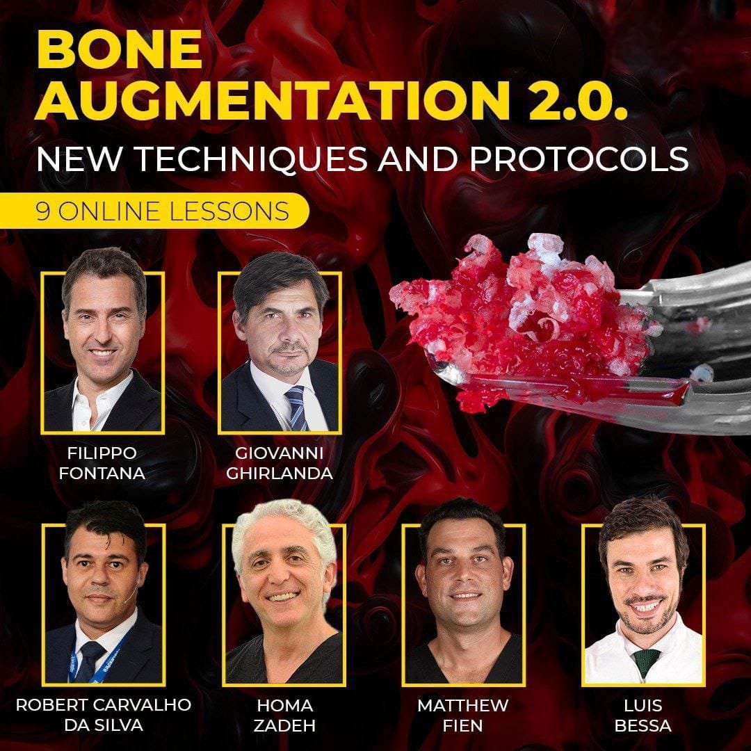 Bone Augmentation 2.0: New Techniques And Protocols