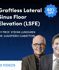 Graftless Lateral Sinus Floor Elevation (LSFE)