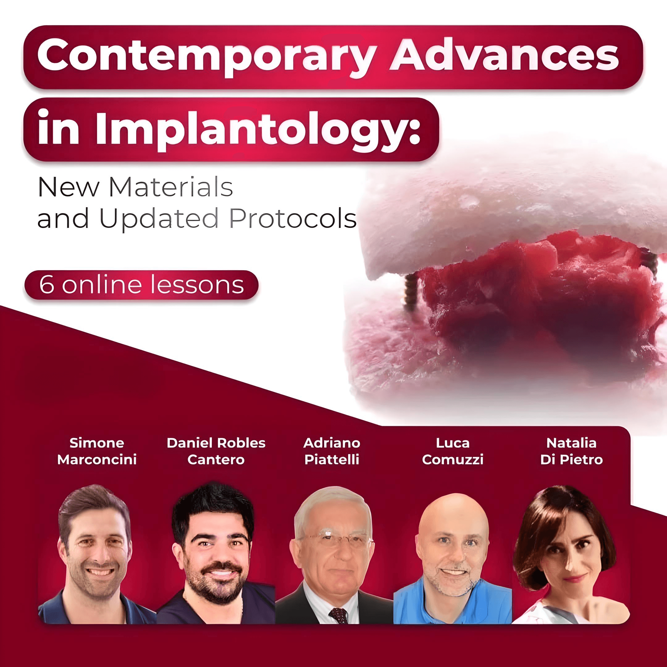 Contemporary Advances in Implantology: New Materials and Updated Protocols