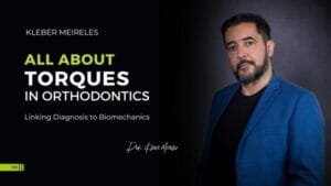 All About Torques In Orthodontics