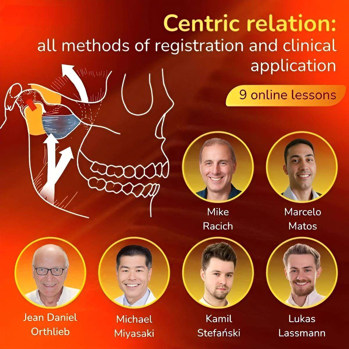 Centric Relation: All Methods of Registration and Clinical Application