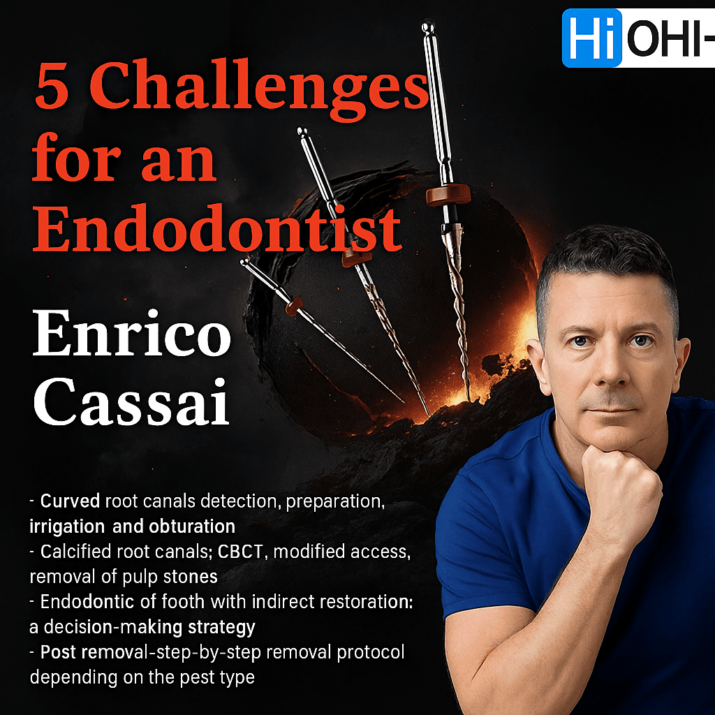 5 Challenges for an Endodontist – Enrico Cassai