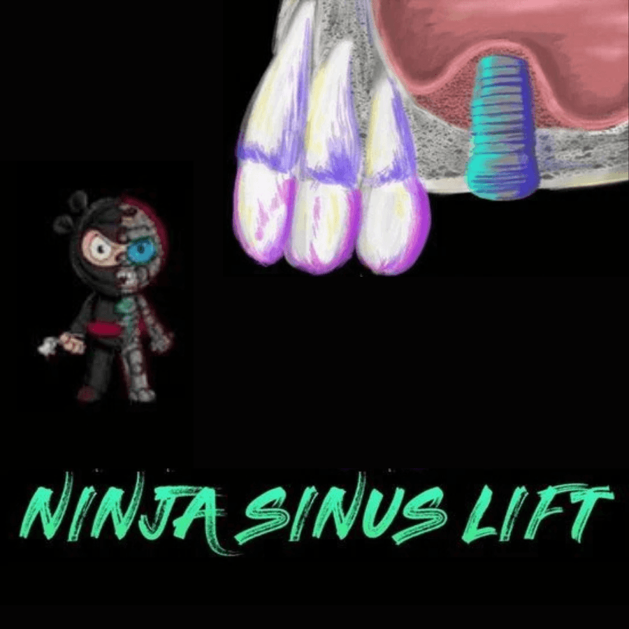 Ninja Sinus Lift Course