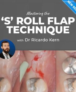The S Roll Flap Technique