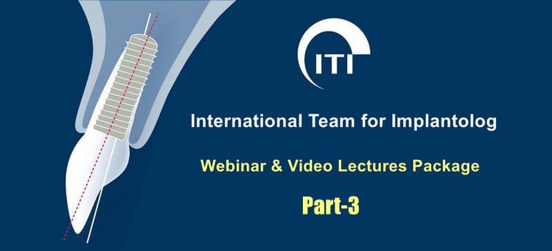 ITI International Team for Implantology Webinar & Video Lectures Package Part-4