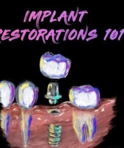 Implant Restorations 101