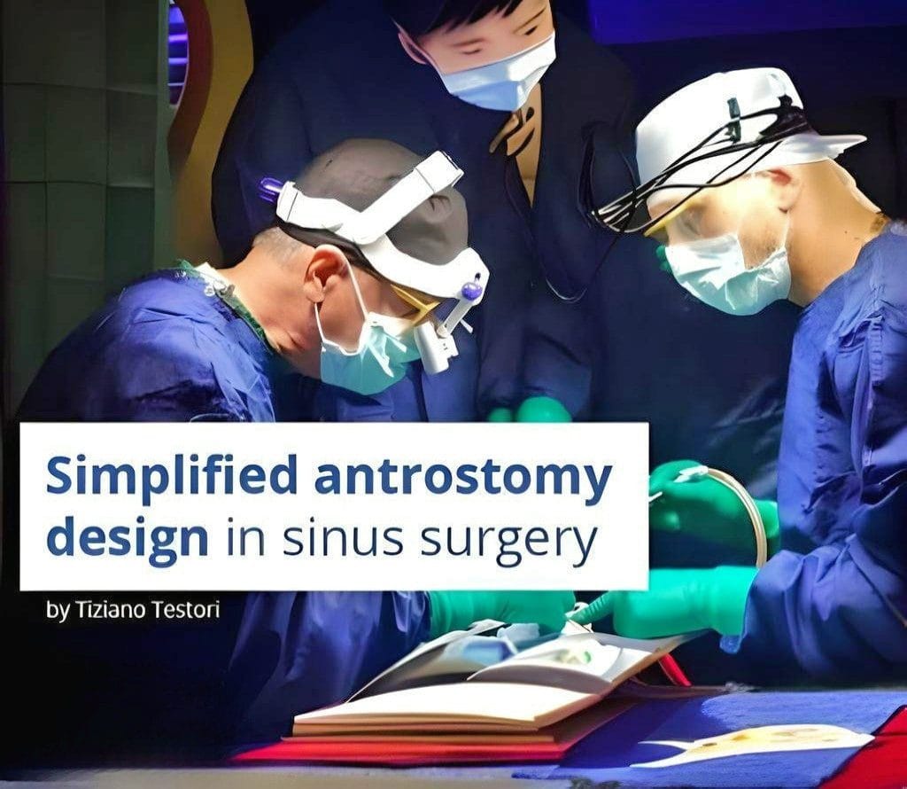 Simplified Antrostomy Design in Maxillary Sinus Surgery