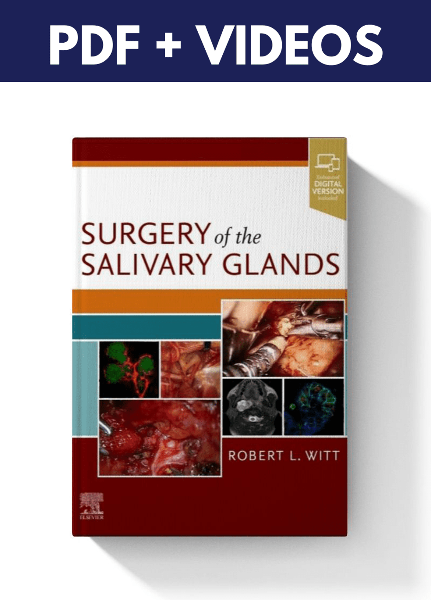 Surgery of the Salivary Glands ( PDF & Videos)