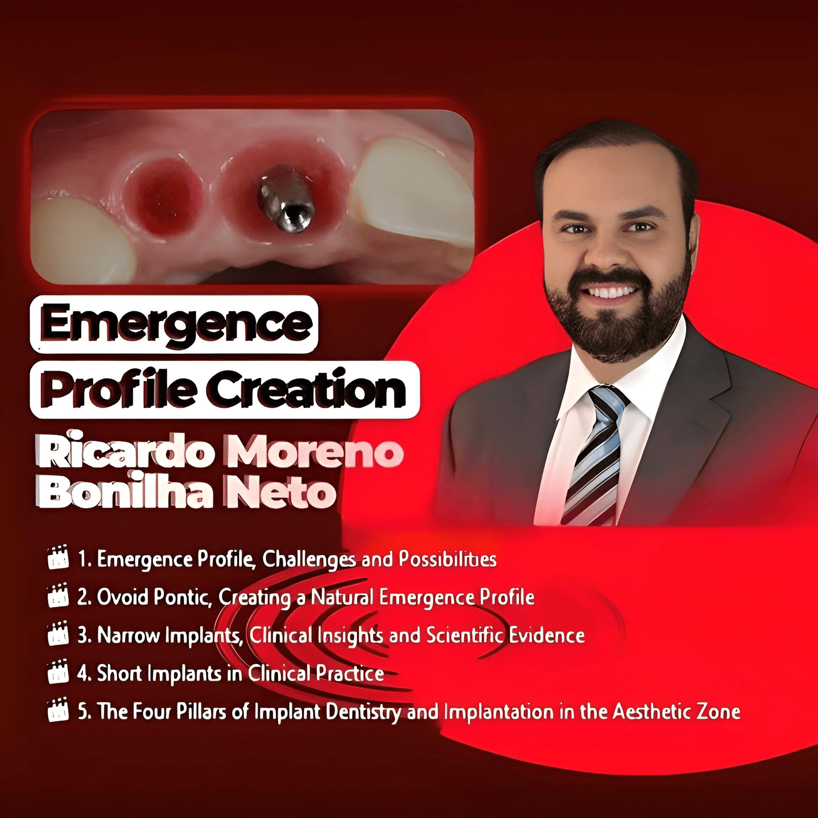 Emergence Profile Creation. Biologically Driven Implantology