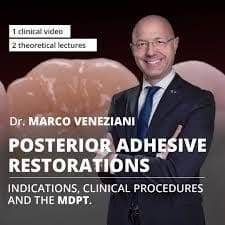 Posterior Adhesive Restorations: Indications, Clinical Procedures and mDPT Techniques / Marco Veneziani