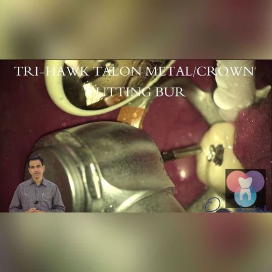 Retreatment in Endodontics – Certificate Course