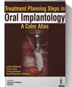 Treatment Planning Steps in Oral Implantology: A Color Atlas