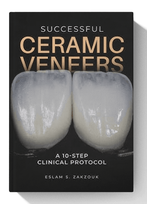 Successful Ceramic Veneers: 10 Steps Clinical Protocol