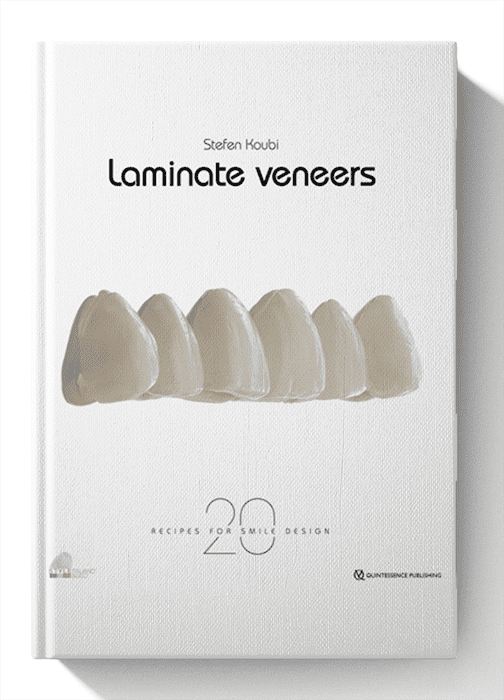Laminate Veneers: 20 Recipes for Smile Design 1st Edition