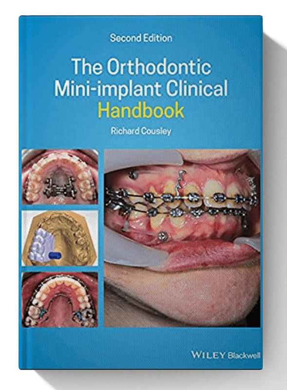 The Orthodontic Mini-implant Clinical Handbook 2nd Edition