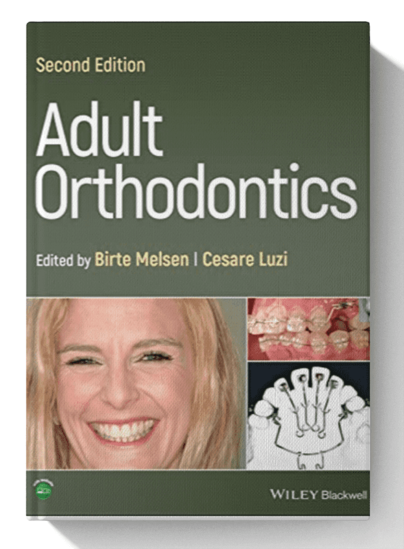 Adult Orthodontics 2nd Edition