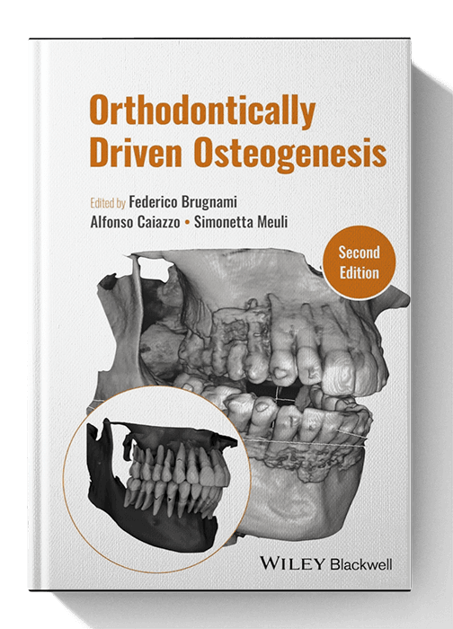 Orthodontically Driven Osteogenesis 2nd Edition