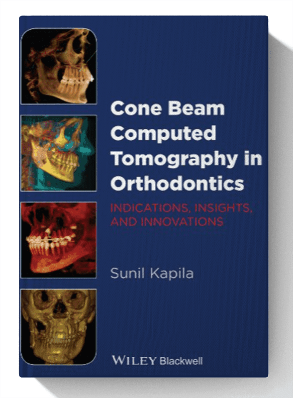 Cone Beam Computed Tomography in Orthodontics: Indications, Insights, and Innovations 1st Edition
